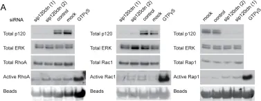 Fig.4.A showing Western Blotting in a Homo sapiens (Human) sample from the publication: p120ctn and P-cadherin but not E-cadherin regulate cell motility and invasion of DU145 prostate cancer cells.