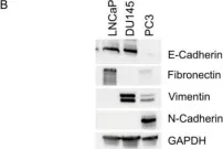 Fig.1.B showing Western Blotting from the publication: Liver X Receptors Enhance Epithelial to Mesenchymal Transition in Metastatic Prostate Cancer Cells.