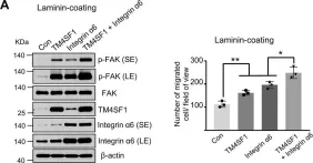 Fig.5.A showing Western Blotting from the publication: TM4SF1 promotes esophageal squamous cell carcinoma metastasis by interacting with integrin α6.