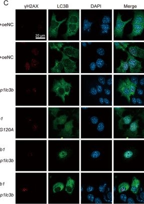 Fig.10.C showing Immunocytochemistry-immunofluorescence in a Mus musculus (House mouse) sample from the publication: LC3B Mediated SETDB1-Accounted Alcoholic Steatohepatitis via Lipidation-Dependent LAP and Lipidation-Independent Nuclear Stabilization.