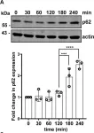 Fig.2.A showing Western Blotting in a Homo sapiens (Human) sample from the publication: Loss of the Essential Autophagy Regulators FIP200 or Atg5 Leads to Distinct Effects on Focal Adhesion Composition and Organization.