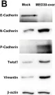 Fig.6.B showing Western Blotting from the publication: MED30 Regulates the Proliferation and Motility of Gastric Cancer Cells.