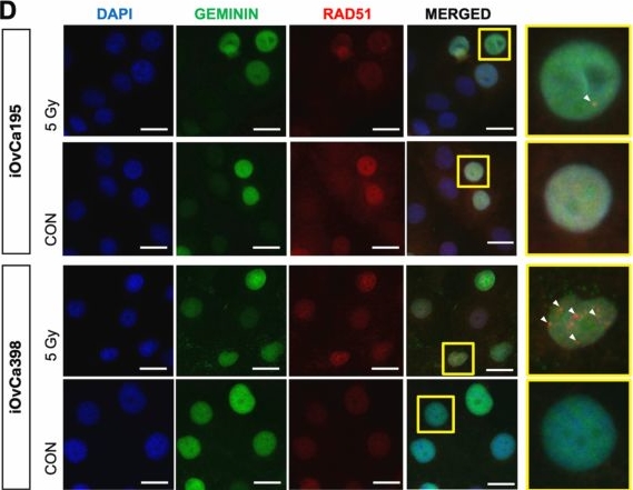Fig.2.D showing Immunocytochemistry-immunofluorescence in a Homo sapiens (Human) sample from the publication: Evaluating carboplatin and PARP inhibitor combination efficacy using high-grade serous carcinoma spheroids and organoids.
