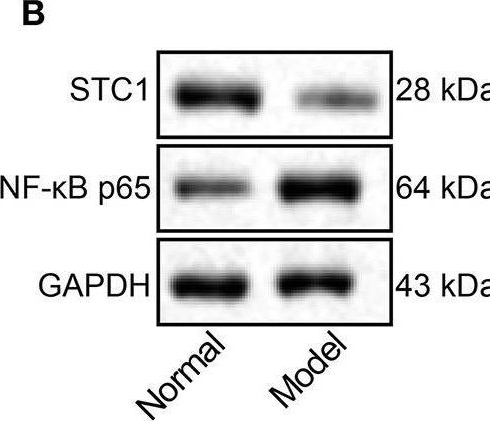 Fig.2.B showing Western Blotting in a Rattus norvegicus (Rat) sample from the publication: Stanniocalcin-1 Overexpression Prevents Depression-Like Behaviors Through Inhibition of the ROS/NF-κB Signaling Pathway.