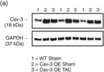 Fig.3.A showing Western Blotting in a Mus musculus (House mouse) sample from the publication: Cardiac-specific overexpression of caveolin-3 preserves t-tubular ICa during heart failure in mice.