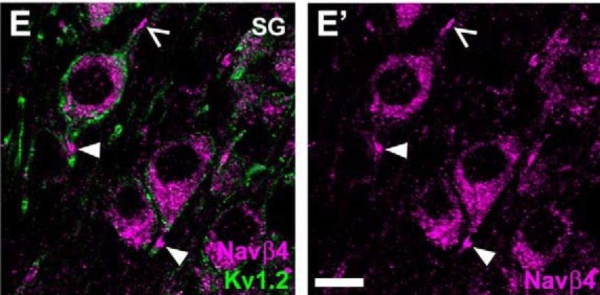 Fig.4.E showing Immunohistochemistry-immunofluorescence in a Mus musculus (House mouse) sample from the publication: Identification of Persistent and Resurgent Sodium Currents in Spiral Ganglion Neurons Cultured from the Mouse Cochlea.