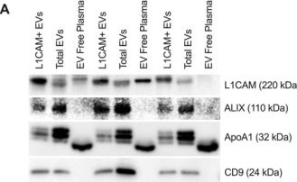 Fig.1.A showing Western Blotting from the publication: Neuronal-Derived EV Biomarkers Track Cognitive Decline in Alzheimer's Disease.