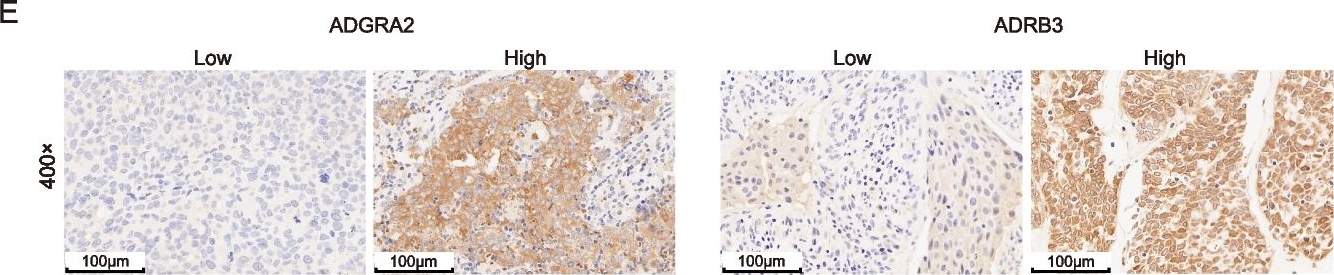 Fig.6.E showing Immunohistochemistry in a Homo sapiens (Human) sample from the publication: Genomic and transcriptomic analysis of breast cancer identifies novel signatures associated with response to neoadjuvant chemotherapy.