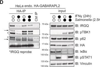 Fig.4.D showing Western Blotting in a Mus musculus (House mouse) sample from the publication: TBK1 restricts IRGQ-mediated autophagy.