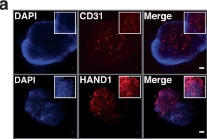 Fig.3.A showing Immunocytochemistry-immunofluorescence in a Homo sapiens (Human) sample from the publication: Rapid and scalable personalized ASO screening in patient-derived organoids.