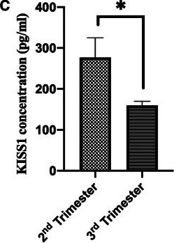 Fig.1.C showing Enzyme-linked immunosorbent assay from the publication: Kisspeptin expression levels in patients with placenta previa: A randomized trial.