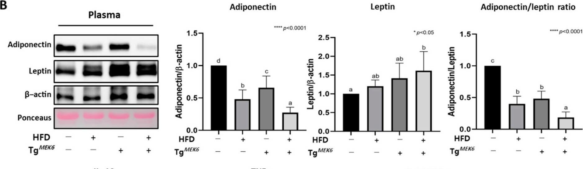 Fig.6.B showing Western Blotting from the publication: MEK6 Overexpression Exacerbates Fat Accumulation and Inflammatory Cytokines in High-Fat Diet-Induced Obesity.