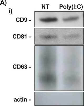 Fig.2.A showing Western Blotting in a Homo sapiens (Human) sample from the publication: Viral dsRNA triggers human fetal membrane miR-146a-3p to be packaged into small extracellular vesicles which in turn drives inflammation through activation of Toll-like Receptor 7 and 8.