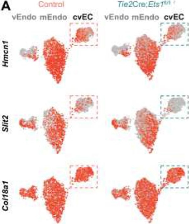 Fig.5.A from the publication: Ets1-regulated endothelial-secreted factors promote compact myocardial growth and contribute to the pathogenesis of ventricular non-compaction.
