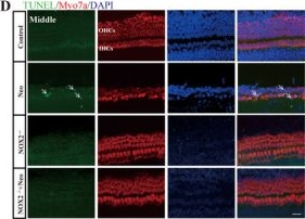 Fig.5.D showing Immunohistochemistry-immunofluorescence in a Mus musculus (House mouse) sample from the publication: NOX2 Contributes to High-Frequency Outer Hair Cell Vulnerability in the Cochlea.