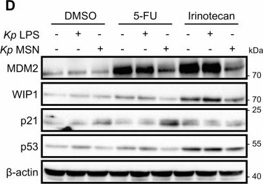 Fig.3.D showing Western Blotting from the publication: Klebsiella pneumoniae LPS drives stromal-mediated repression of p53 and colorectal cancer chemoresistance.
