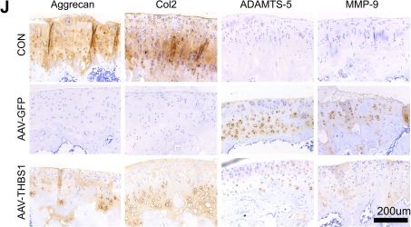 Fig.2.J showing Immunohistochemistry from the publication: Thrombospondin-1 mitigates osteoarthritis progression by inhibiting mechanical stress-induced chondrocyte ferroptosis via the integrin/YAP pathway.