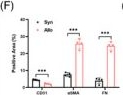 Fig.2.F showing Enzyme-linked immunosorbent assay from the publication: Rictor/mTORC2 signalling contributes to renal vascular endothelial-to-mesenchymal transition and renal allograft interstitial fibrosis by regulating BNIP3-mediated mitophagy.
