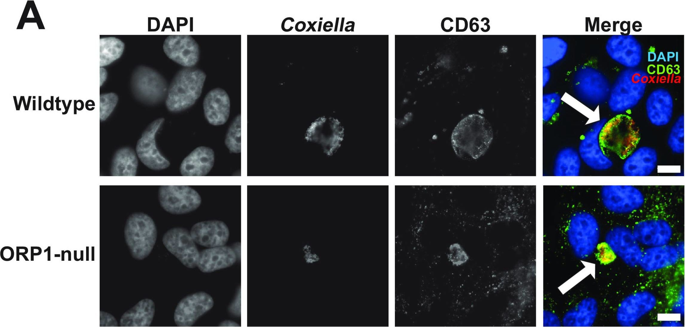 Fig.2.A showing Immunocytochemistry-immunofluorescence from the publication: Host Lipid Transport Protein ORP1 Is Necessary for Coxiella burnetii Growth and Vacuole Expansion in Macrophages.