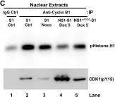 Fig.4.C showing Western Blotting in a Homo sapiens (Human) sample from the publication: Parvovirus B19 NS1 protein induces cell cycle arrest at G2-phase by activating the ATR-CDC25C-CDK1 pathway.