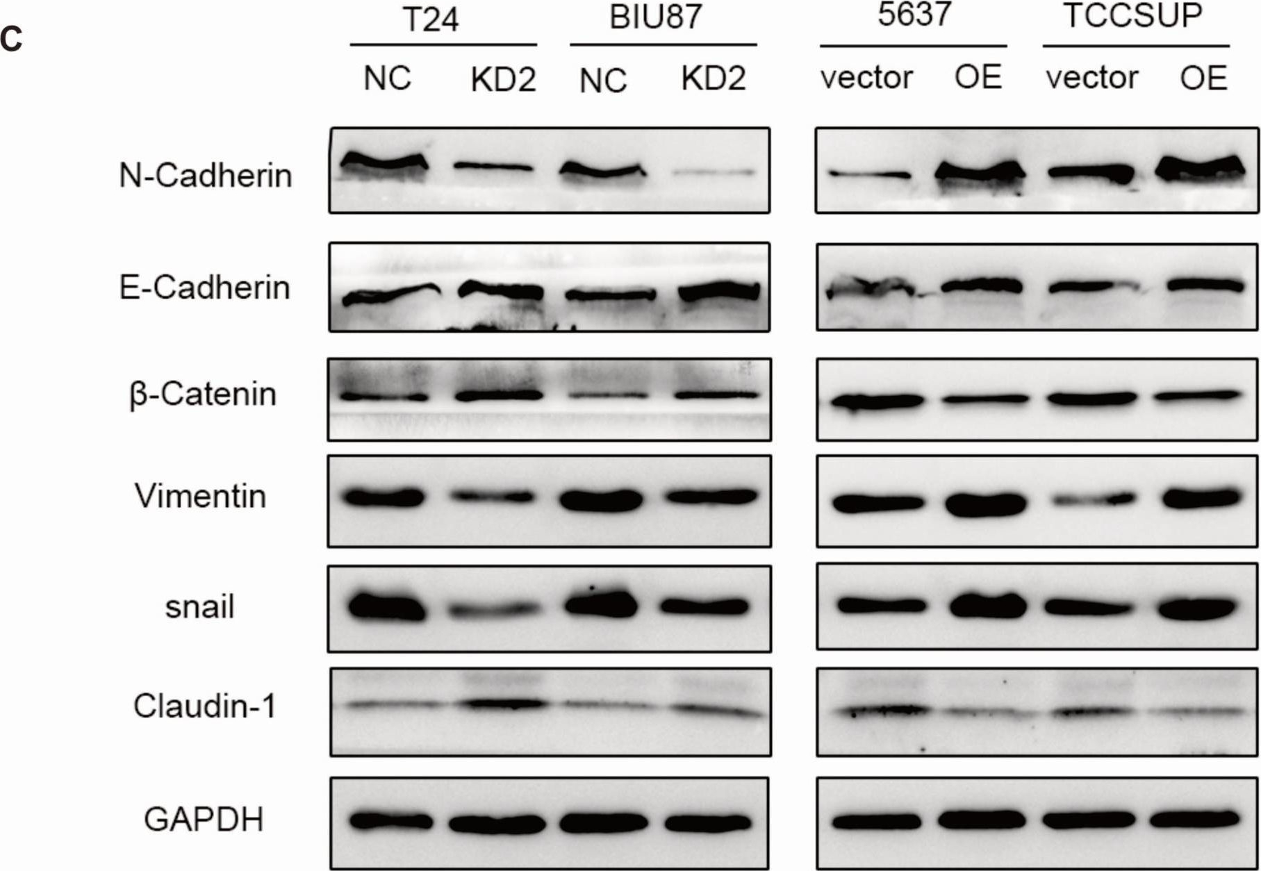 Fig.3.C showing Western Blotting from the publication: ADNP prompts the cisplatin-resistance of bladder cancer via TGF-β-mediated epithelial-mesenchymal transition (EMT) pathway.