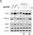 Fig.7.D showing Western Blotting from the publication: Rapalogs can promote cancer cell stemness in vitro in a Galectin-1 and H-ras-dependent manner.