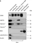 Fig.2.A showing Western Blotting in a Homo sapiens (Human) sample from the publication: Comparative analysis of extracellular vesicle isolation methods from human AML bone marrow cells and AML cell lines.