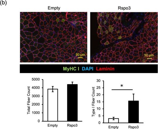 Fig.4.B showing Immunohistochemistry-immunofluorescence in a Mus musculus (House mouse) sample from the publication: R-spondin 3 is a myokine that mediates type I fiber determination during skeletal muscle regeneration.