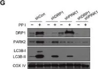 Fig.5.G showing Western Blotting in a Homo sapiens (Human) sample from the publication: Polyphyllin I induces mitophagic and apoptotic cell death in human breast cancer cells by increasing mitochondrial PINK1 levels.