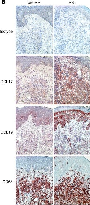 Fig.7.B showing Immunohistochemistry from the publication: Dynamics of Th1/Th17 responses and antimicrobial pathways in leprosy skin lesions.