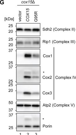 Fig.3.G showing Western Blotting from the publication: Molecular analysis of a new patient COX15 mutation provides insight into the etiology of fatal infantile cardioencephalopathy.