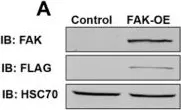 Fig.2.A showing Western Blotting from the publication: FAK-Mediated Signaling Controls Amyloid Beta Overload, Learning and Memory Deficits in a Mouse Model of Alzheimer's Disease.