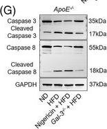Fig.8.G showing Western Blotting in a Mus musculus (House mouse) sample from the publication: Macrophage-derived galectin-3 contributes to pyroptosis, apoptosis and necroptosis through TLR4/MyD88/NF-κB/NLRP3 during atherosclerosis.