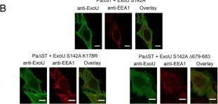 Fig.5.B showing Immunocytochemistry-immunofluorescence from the publication: Structural basis of cytotoxicity mediated by the type III secretion toxin ExoU from Pseudomonas aeruginosa.