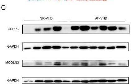 Fig.10.C showing Western Blotting in a Homo sapiens (Human) sample from the publication: Construction of Prediction Model for Atrial Fibrillation with Valvular Heart Disease Based on Machine Learning.