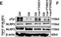 Fig.6.E showing Western Blotting from the publication: Lactylation-Driven YTHDC1 Alleviates MASLD by Suppressing PTPN22-Mediated Dephosphorylation of NLRP3.