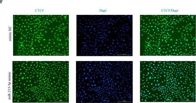 Fig.4.F showing Immunocytochemistry-immunofluorescence from the publication: miR-215-5p Suppresses Proliferation/Cell-Cycle Progression and Promotes Apoptosis via Targeting CTCF in Goat Mammary Epithelial Cells.