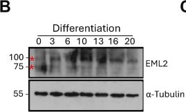 Fig.2.B showing Western Blotting in a Homo sapiens (Human) sample from the publication: EML2 and EML4 splice variants regulate microtubule remodeling during neuronal cell differentiation.