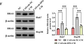 Fig.5.F showing Western Blotting from the publication: CAFs-derived SPI1 in tumor fibroblasts promotes malignant behaviors of liver cancer cells and immune escape by regulating HRAS and PD-L1 transcription.