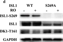 Fig.3.D showing Western Blotting from the publication: Phosphorylation of islet-1 serine 269 by CDK1 increases its transcriptional activity and promotes cell proliferation in gastric cancer.
