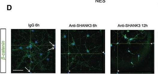 Fig.1.D showing Immunocytochemistry-immunofluorescence in a Mus musculus (House mouse) sample from the publication: Axin2 coupled excessive Wnt-glycolysis signaling mediates social defect in autism spectrum disorders.