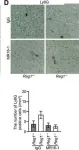 Fig.5.D showing Immunohistochemistry from the publication: Cytokine mRNA Degradation in Cardiomyocytes Restrains Sterile Inflammation in Pressure-Overloaded Hearts.