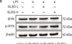 Syk (D3Z1E) Rabbit Monoclonal Antibody | Cell Signaling Technology