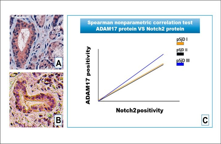Fig.7.A showing Immunohistochemistry in a Homo sapiens (Human) sample from the publication: Correlated Expression of Notch2 and ADAM17 in Primary Sjögren's Syndrome Salivary Glands.