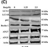Fig.5.C showing Western Blotting from the publication: Ro 31-8220 suppresses bladder cancer progression via enhancing autophagy in vitro and in vivo.