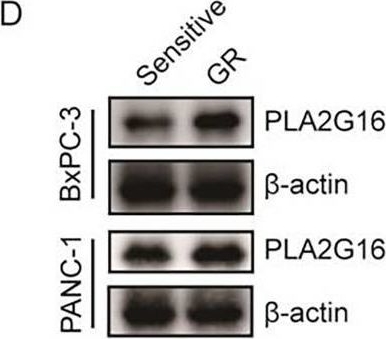 Fig.3.D showing Western Blotting in a Homo sapiens (Human) sample from the publication: PLA2G16 expression predicts prognosis and gemcitabine sensitivity in patients with pancreatic cancer.