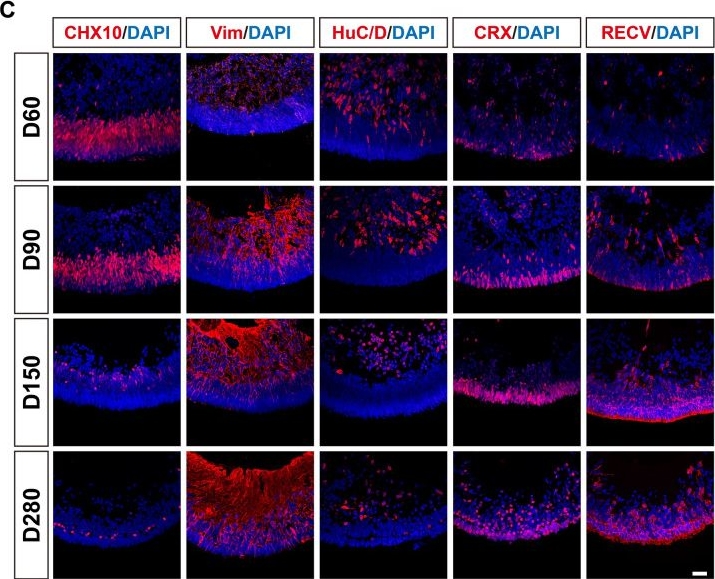Fig.1.C showing Immunohistochemistry-immunofluorescence in a Homo sapiens (Human) sample from the publication: The influence of SARS-CoV-2 spike protein exposure on retinal development in the human retinal organoids.