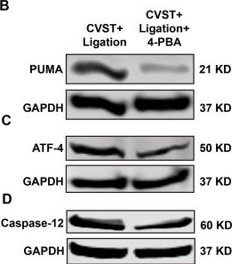 Fig.8.B showing Western Blotting in a Mus musculus (House mouse) sample from the publication: Meningeal lymphatic vessel dysfunction exacerbates brain injury in CVST mice via endoplasmic reticulum and oxidative stress pathways.