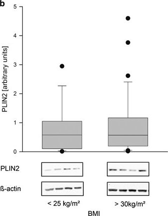 Maternal obesity modulates intracellular lipid turnover in the human term placenta.