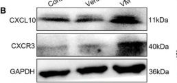 Fig.4.B showing Western Blotting from the publication: CXCL10 Involvement in Vestibular Migraine via the PI3K/AKT Signaling Pathway.